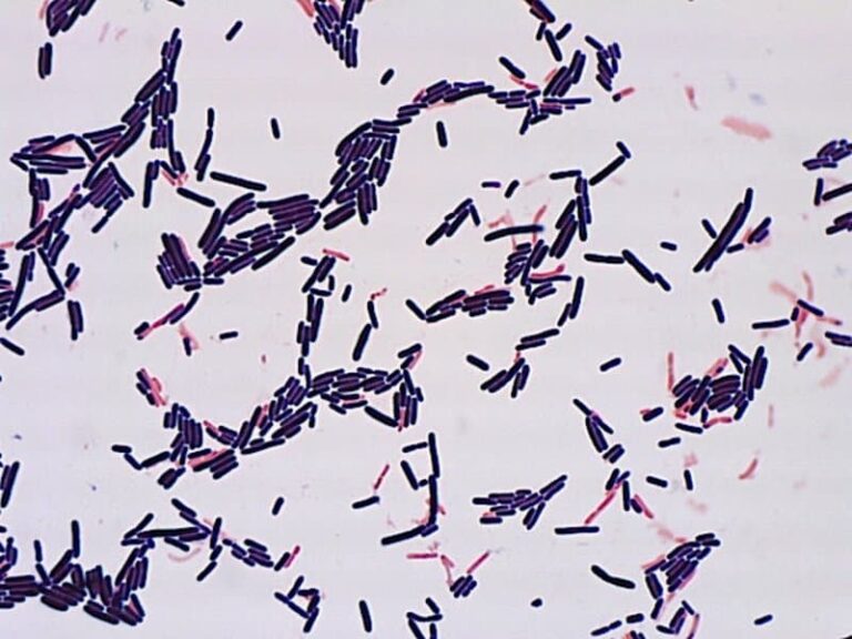 Peran Probiotik Lactobacillus pada Alergi